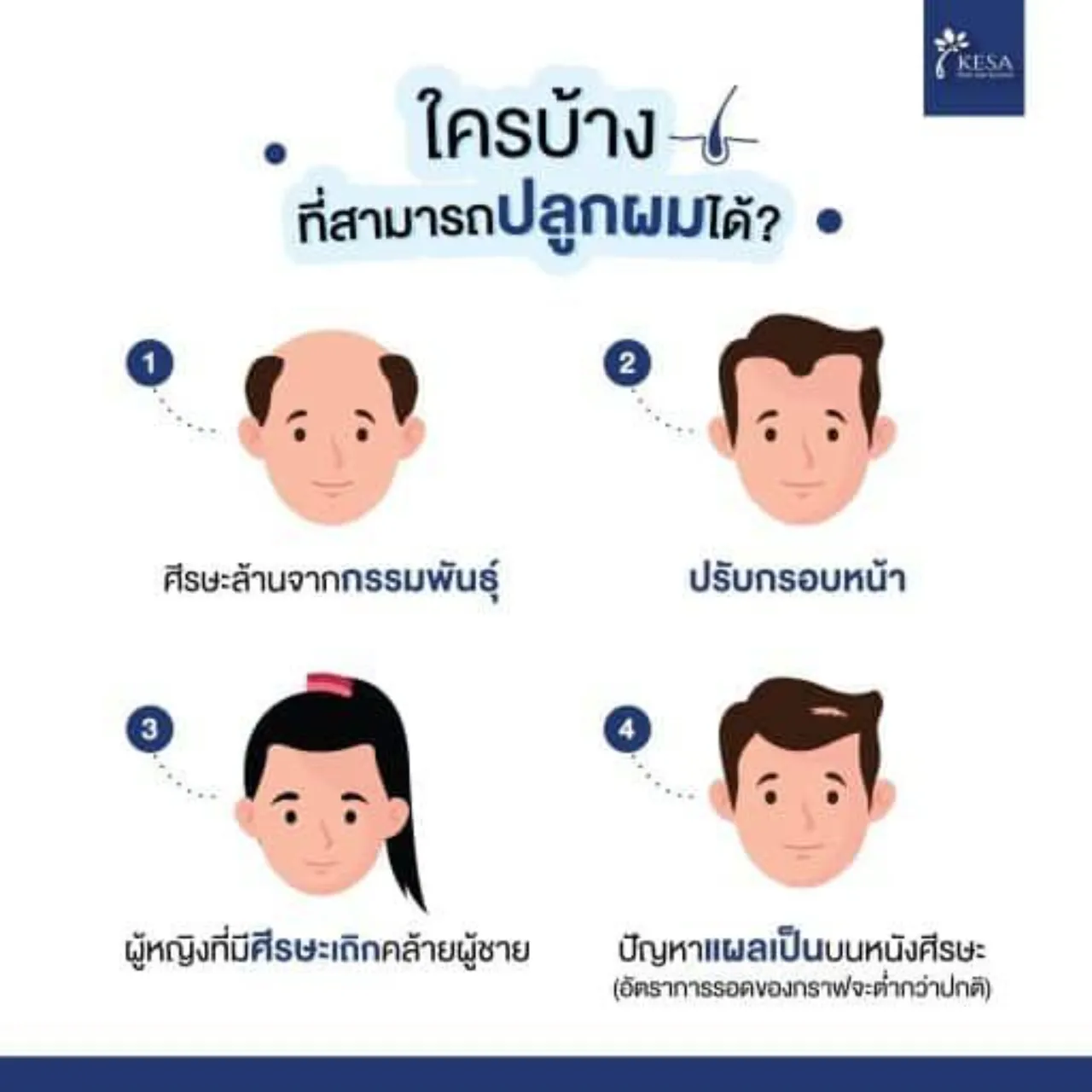 ใครบ้างที่สามารถปลูกผมได้?