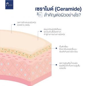 Content - Ceramide-01 – เกศา คลินิก - kesa hair clinic – เกศา คลินิก - kesa hair clinic Content - Ceramide-01 เกศา คลินิก - kesa hair clinic เกศา คลินิก - kesa hair clinic