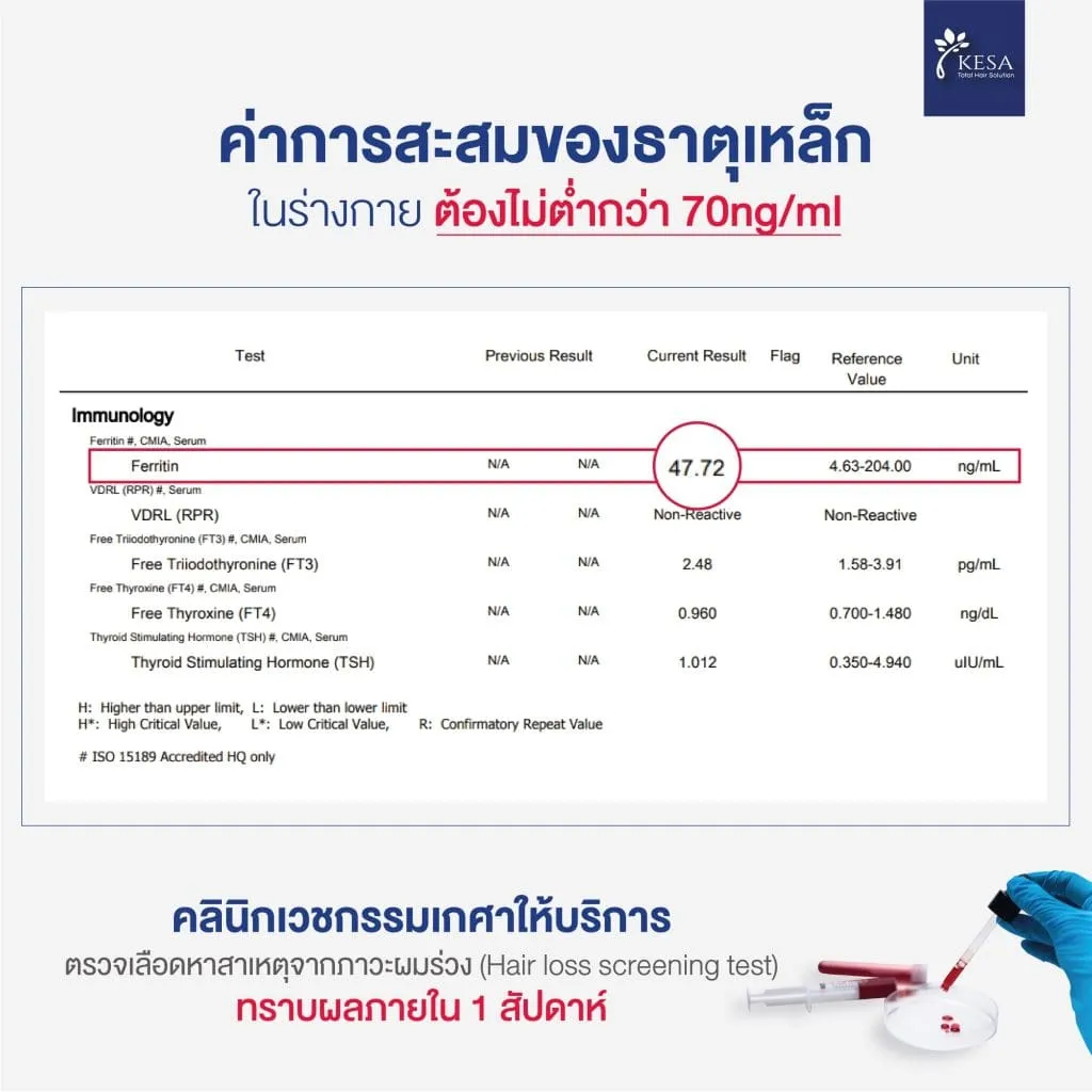 ค่าการสะสมของธาตุเหล็ก