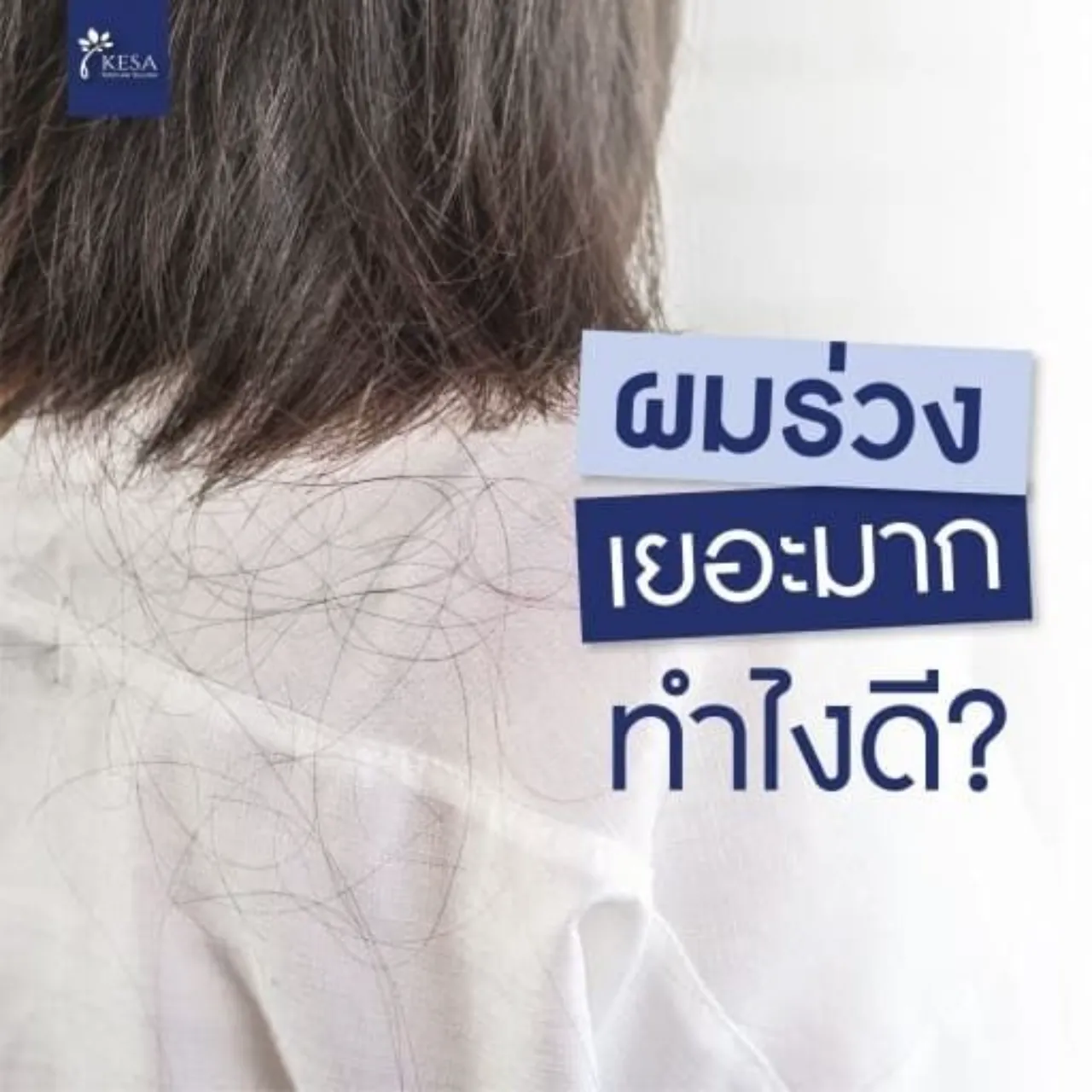 ผมร่วงเยอะมาก ทำไงดี?