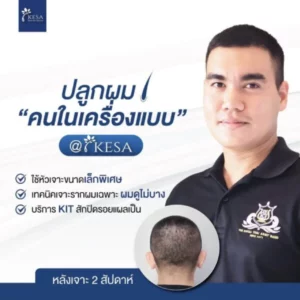 admin-ajax 3 – เกศา คลินิก - kesa hair clinic – เกศา คลินิก - kesa hair clinic admin ajax 3 เกศา คลินิก - kesa hair clinic เกศา คลินิก - kesa hair clinic
