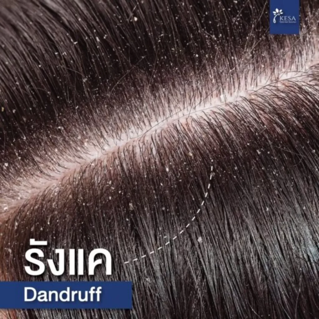 admin ajax 13 เกศา คลินิก - kesa hair clinic