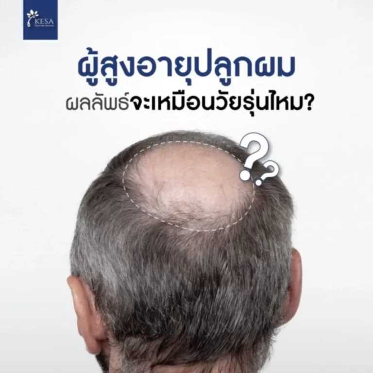 admin ajax 2 1 เกศา คลินิก - kesa hair clinic