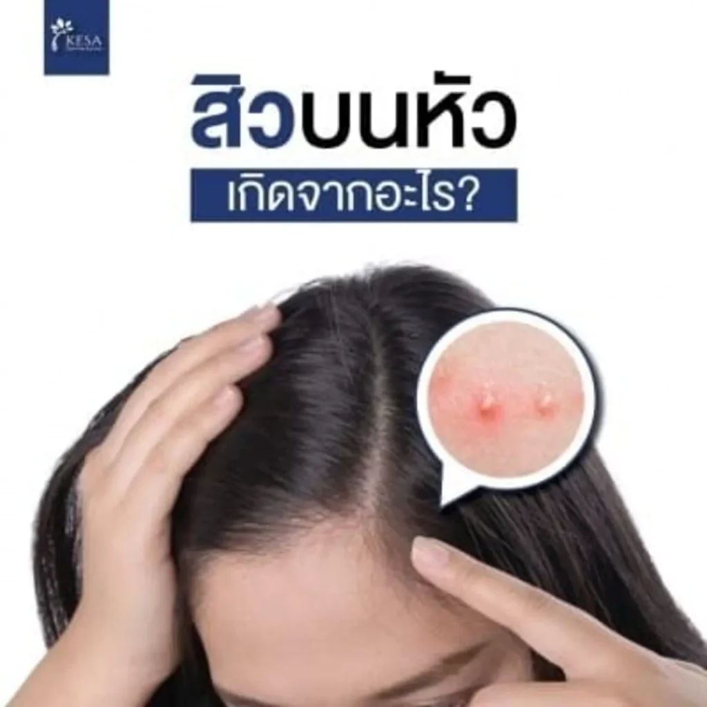admin-ajax 11 – เกศา คลินิก - kesa hair clinic – เกศา คลินิก - kesa hair clinic admin ajax 11 เกศา คลินิก - kesa hair clinic เกศา คลินิก - kesa hair clinic