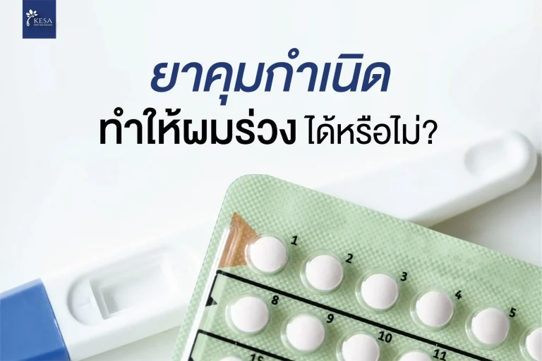 ยาคุมกำเนิดทำให้ผมร่วง เกศา คลินิก - kesa hair clinic