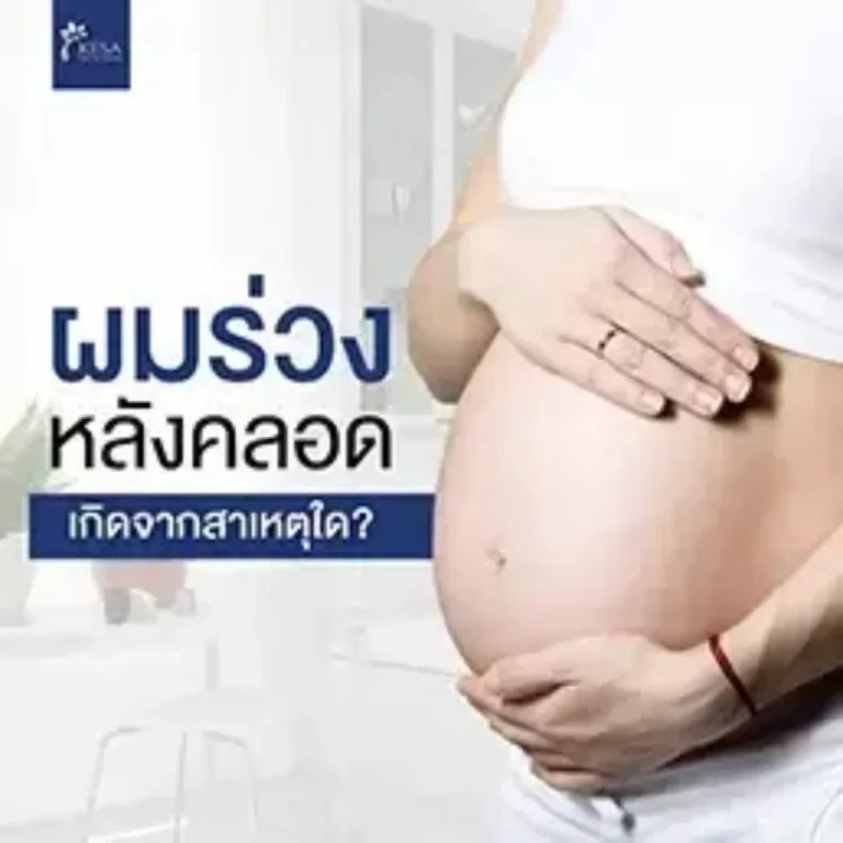 ผมร่วงหลังคลอด เกศา คลินิก - kesa hair clinic