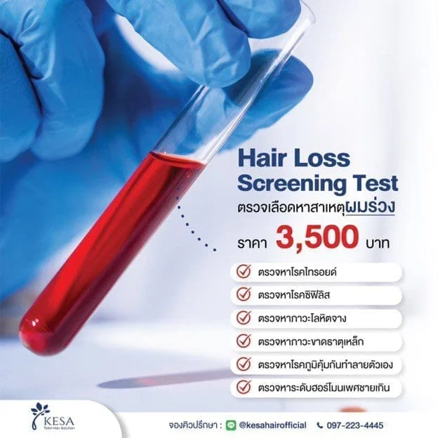 ตรวจเลือดหาสาเหตุผมร่วง – เกศา คลินิก - kesa hair clinic ผมร่วงเกิดจากอะไร เกศา คลินิก - kesa hair clinic