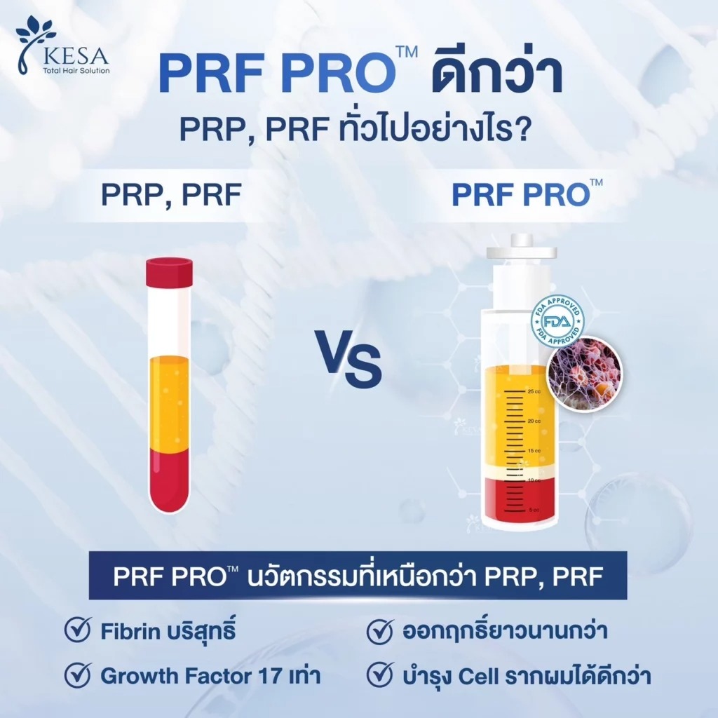 LINE_ALBUM_PRF-PRO_250114_11-1024x1024 – เกศา คลินิก - kesa hair clinic PRF PRO เกศา คลินิก - kesa hair clinic