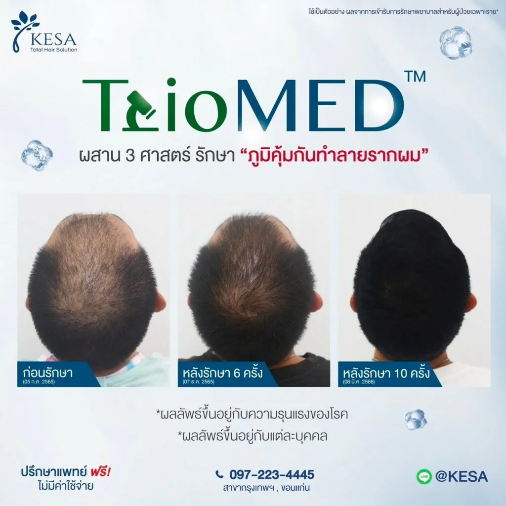 TrioMED เกศา คลินิก - kesa hair clinic
