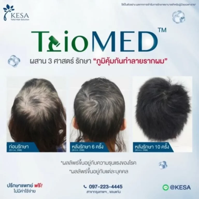 TrioMED เกศา คลินิก - kesa hair clinic