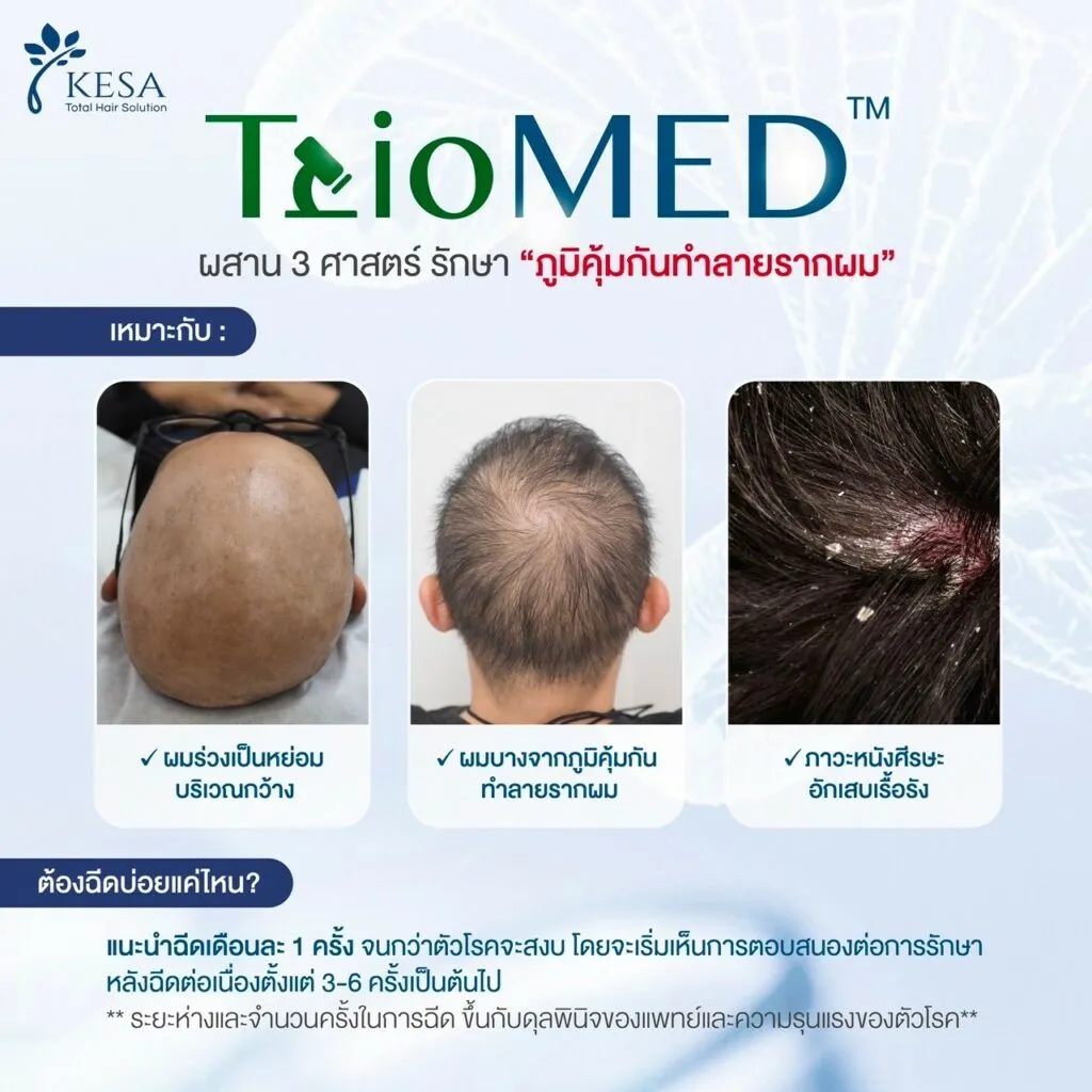 ฉีดรักษาผมบาง เกศา คลินิก - kesa hair clinic
