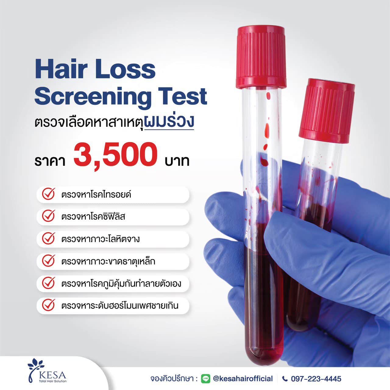 ตรวจเลือดหาสาเหตุผมร่วง เกศา คลินิก - kesa hair clinic