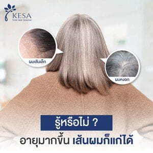 อายุมากขึ้น เส้นผมก็แก่ได้ – เกศา คลินิก - kesa hair clinic – เกศา คลินิก - kesa hair clinic เส้นผมก็แก่ได้ เกศา คลินิก - kesa hair clinic เกศา คลินิก - kesa hair clinic