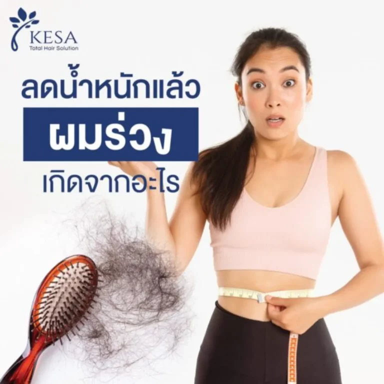 ลดน้ำหนักแล้วผมร่วงเกิดจากอะไร เกศา คลินิก - kesa hair clinic