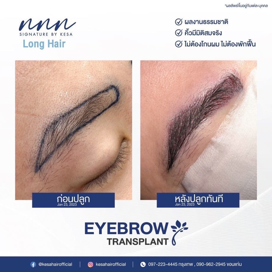 S__56934448 เกศา คลินิก - kesa hair clinic