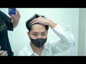  เกศา คลินิก - kesa hair clinic