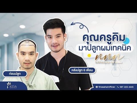 เมื่อคุณครูคิม มาปลูกผมเทคนิค NNN