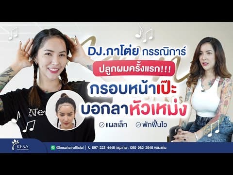 ปลูกผมครั้งแรก!!! ของ “DJ. กาโต่ย กรรณิการ์” กรอบหน้าเป๊ะ บอกลาหัวเหม่งแบบถาวร!!!!