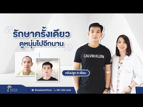 รักษาครั้งเดียวดูหนุ่มไปอีกนาน ด้วยการปลูกผมถาวร
