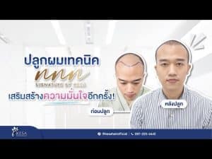  เกศา คลินิก - kesa hair clinic