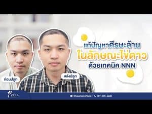 kesa youtube คุณศุภกิจ – เกศา คลินิก - kesa hair clinic kesa youtube คุณศุภกิจ เกศา คลินิก - kesa hair clinic