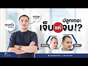 kesa youtube คุณหนึ่ง – เกศา คลินิก - kesa hair clinic – เกศา คลินิก - kesa hair clinic kesa youtube คุณหนึ่ง เกศา คลินิก - kesa hair clinic เกศา คลินิก - kesa hair clinic