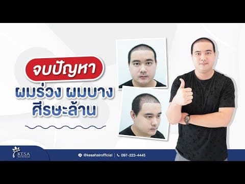  เกศา คลินิก - kesa hair clinic
