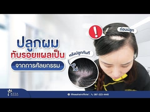 หยุดปัญหาที่คอยกวนใจ ที่ทำให้ความมั่นใจของคุณลดลง