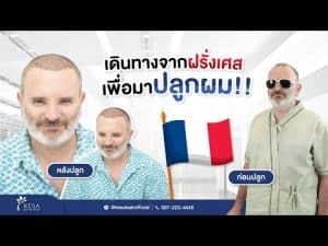 kesa youtube ชาวฝรั่งเศส – เกศา คลินิก - kesa hair clinic kesa youtube ชาวฝรั่งเศส เกศา คลินิก - kesa hair clinic
