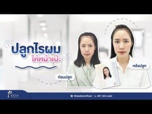  เกศา คลินิก - kesa hair clinic