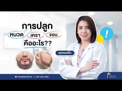 ปลูกหนวด เครา จอน เทคนิค NNN ที่เกศาคลินิก