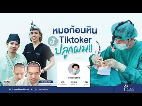 หมอก้อนหิน ศัลยแพทย์ ปลูกผมครั้งแรกที่ Kesa Clinic