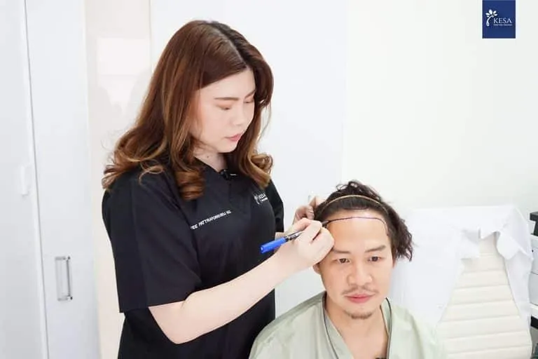 ขั้นตอนการปลูกผม เกศา คลินิก - kesa hair clinic