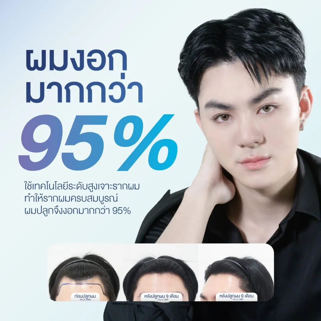 ผมงอกมากกว่า 95% เกศา คลินิก - kesa hair clinic