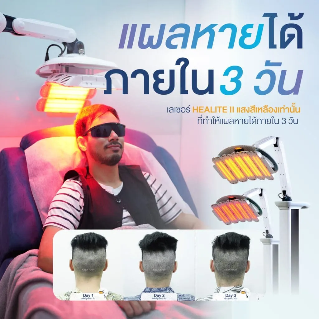 แผลหายได้ภายใน 3 วัน เกศา คลินิก - kesa hair clinic