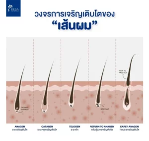 Hair growth cycle เกศา คลินิก - kesa hair clinic