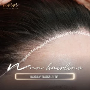 LINE_ALBUM_Content_230926_2-1024x1024 – เกศา คลินิก - kesa hair clinic NNN เกศา คลินิก - kesa hair clinic