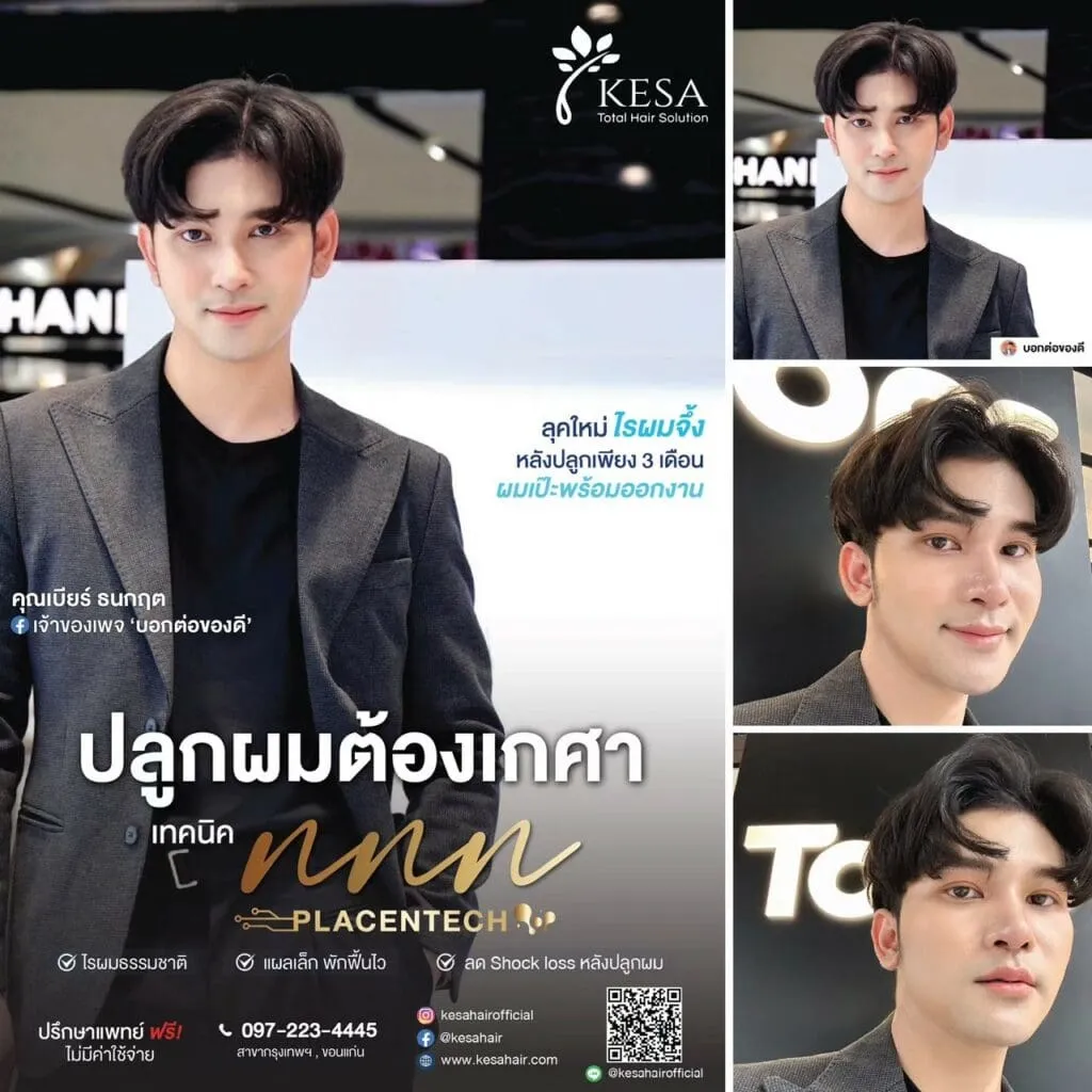 ปลูกผมต้องเกศา