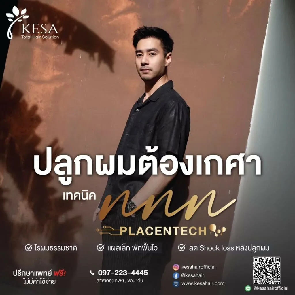 ปลูกผมต้องเกศา