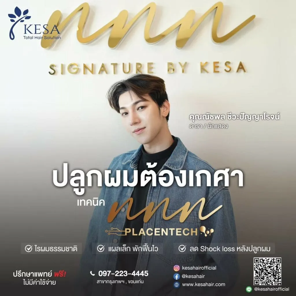 ปลูกผมต้องเกศา