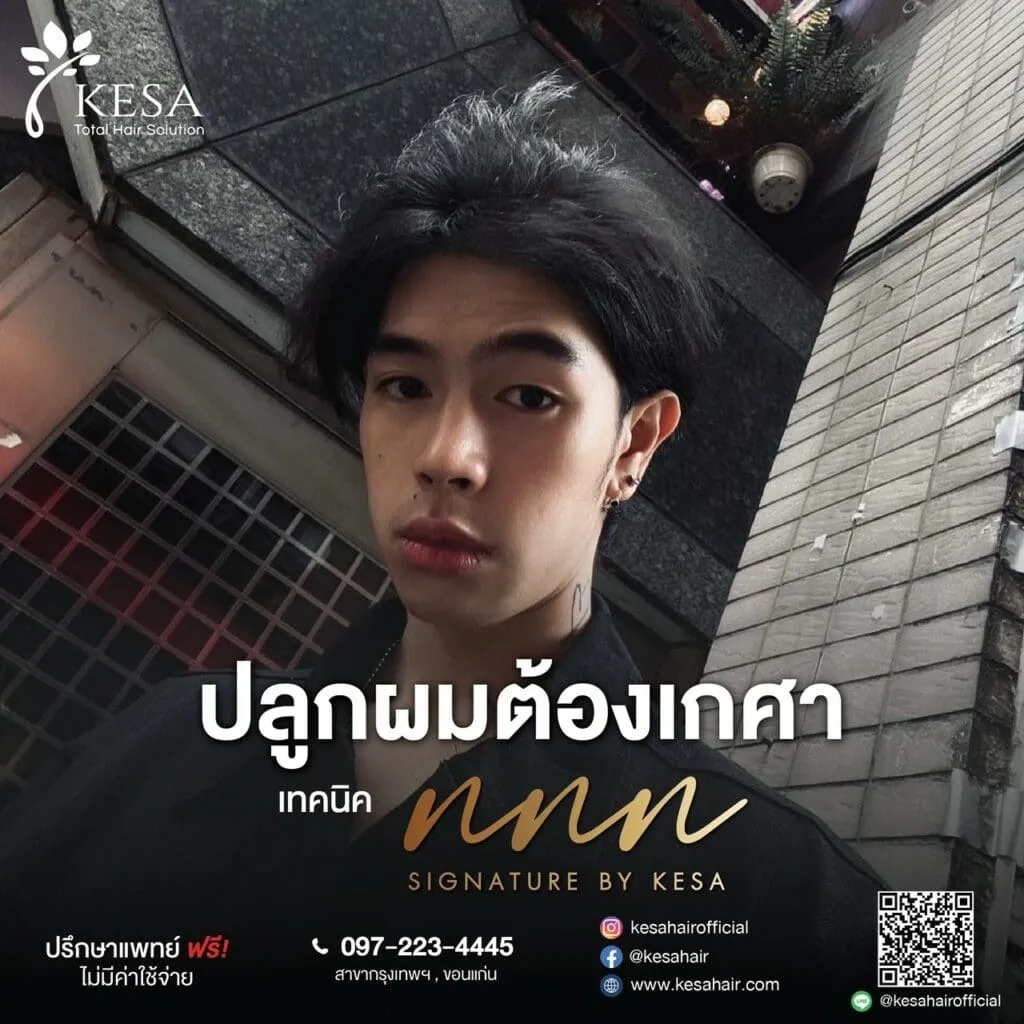 ปลูกผมต้องเกศา