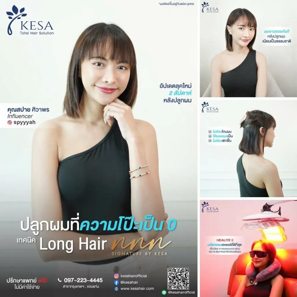 ปลูกผมแบบ long hair เกศา คลินิก - kesa hair clinic
