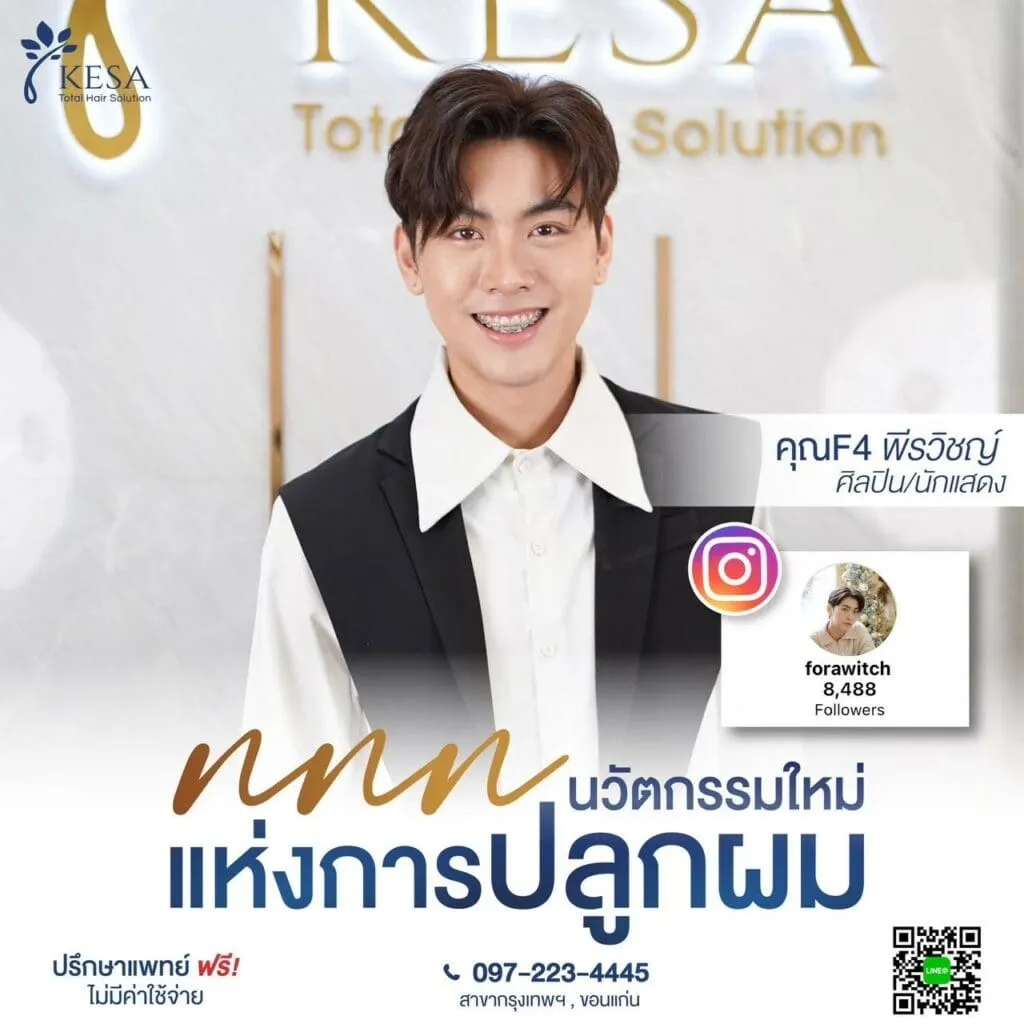 นวัตกรรมใหม่แห่งการปลูกผม