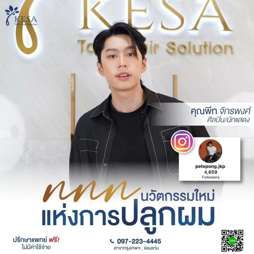 นวัตกรรมใหม่แห่งการปลูกผม