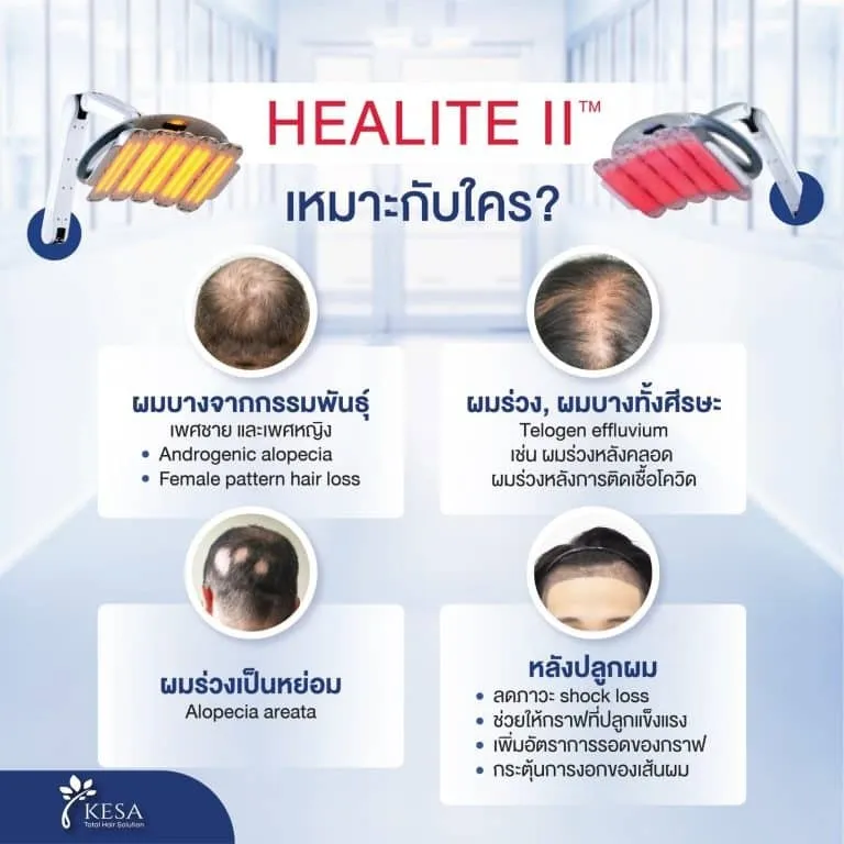 HEALITE II เกศา คลินิก - kesa hair clinic