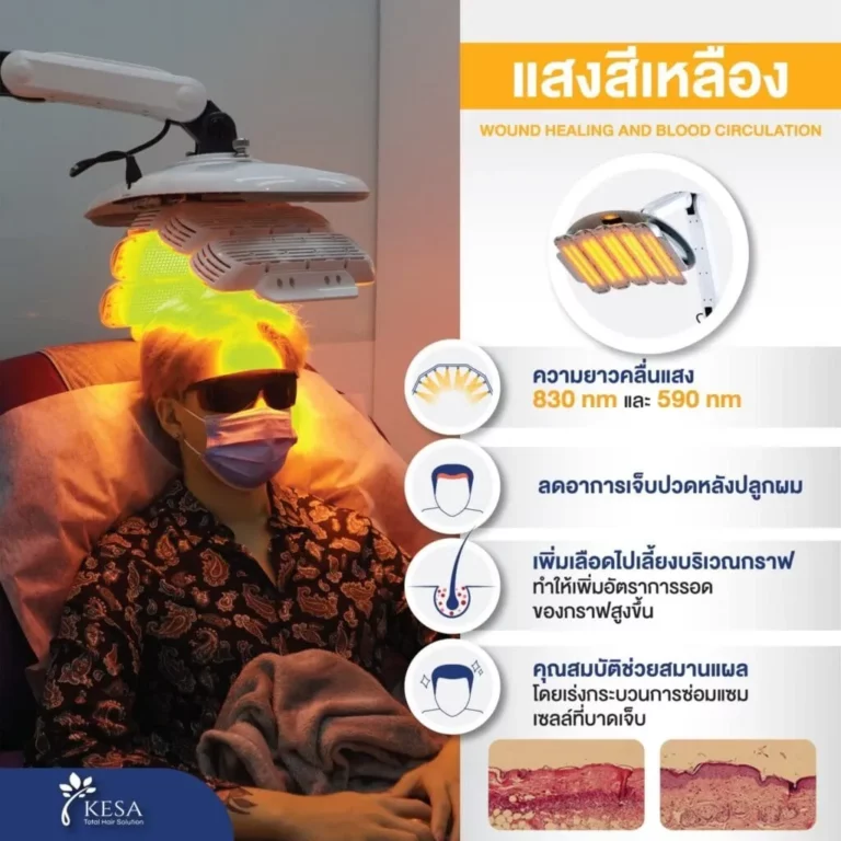 HEALITE II เกศา คลินิก - kesa hair clinic