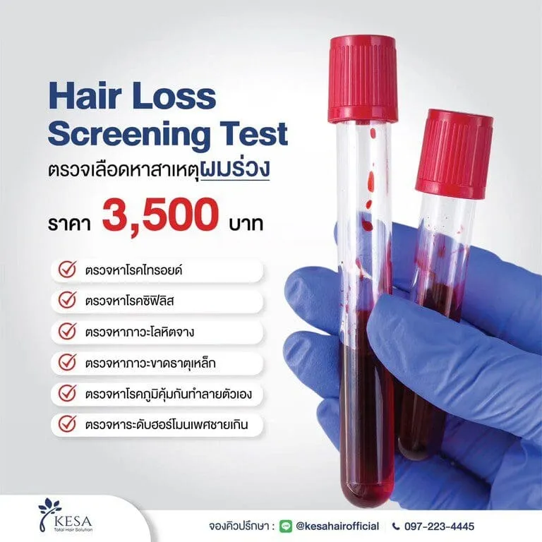 ตรวจเลือดหาสาเหตุผมร่วง เกศา คลินิก - kesa hair clinic