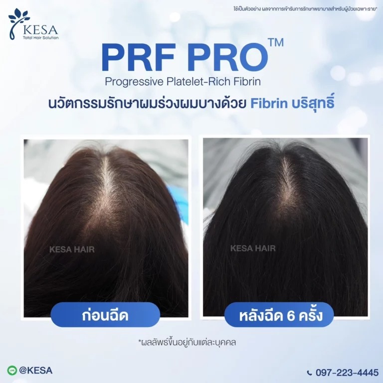 LINE ALBUM PRF PRO 250114 4 768×768