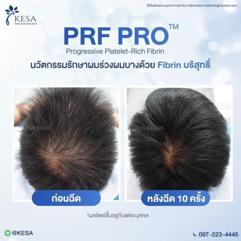 LINE ALBUM PRF PRO 250116 1 0 920×920