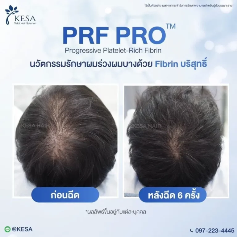 LINE ALBUM PRF PRO 250116 2 0 920×920